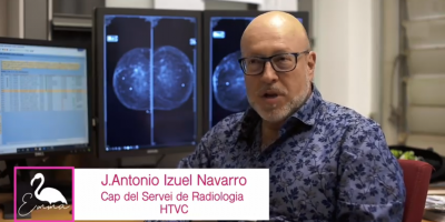 Papel de la radiología en el proceso de diagnóstico del cáncer de mama